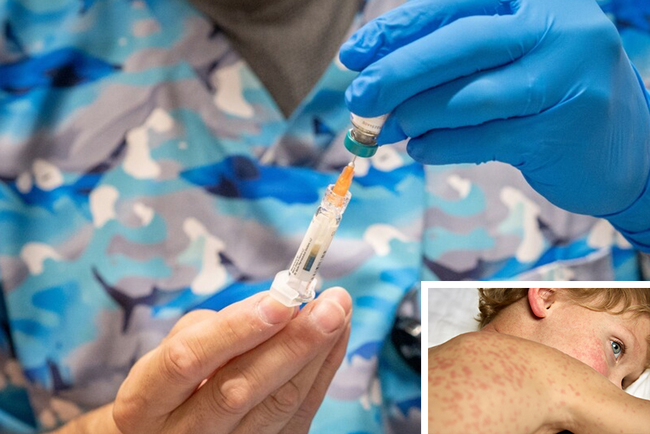 U.S. measles cases continue to climb, with outbreaks across the country