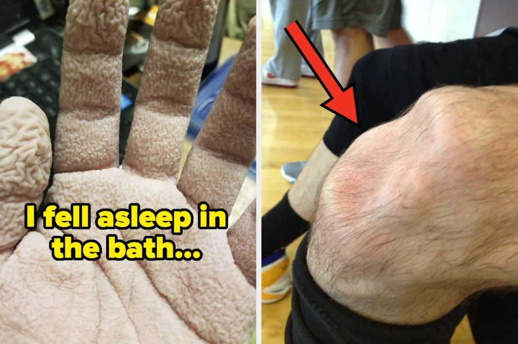 48 Photos Of Conditions, Injuries, And Disorders That Show The Raw Power Of Our Bodies — And Modern Medicine - BuzzFeed