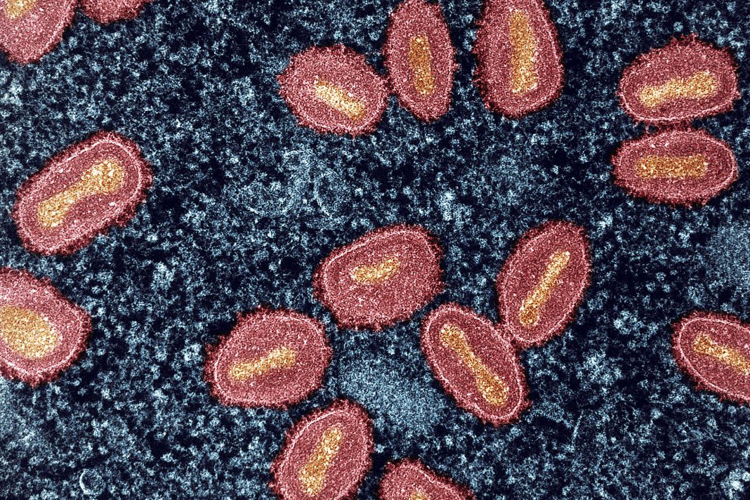 Mpox virus