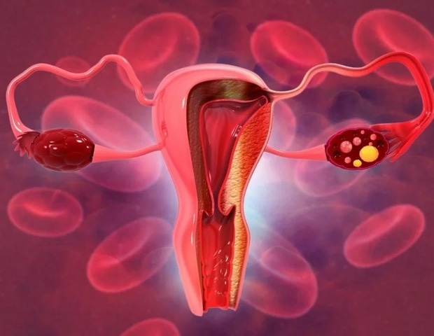 Global collaboration accelerates progress toward eliminating cervical cancer