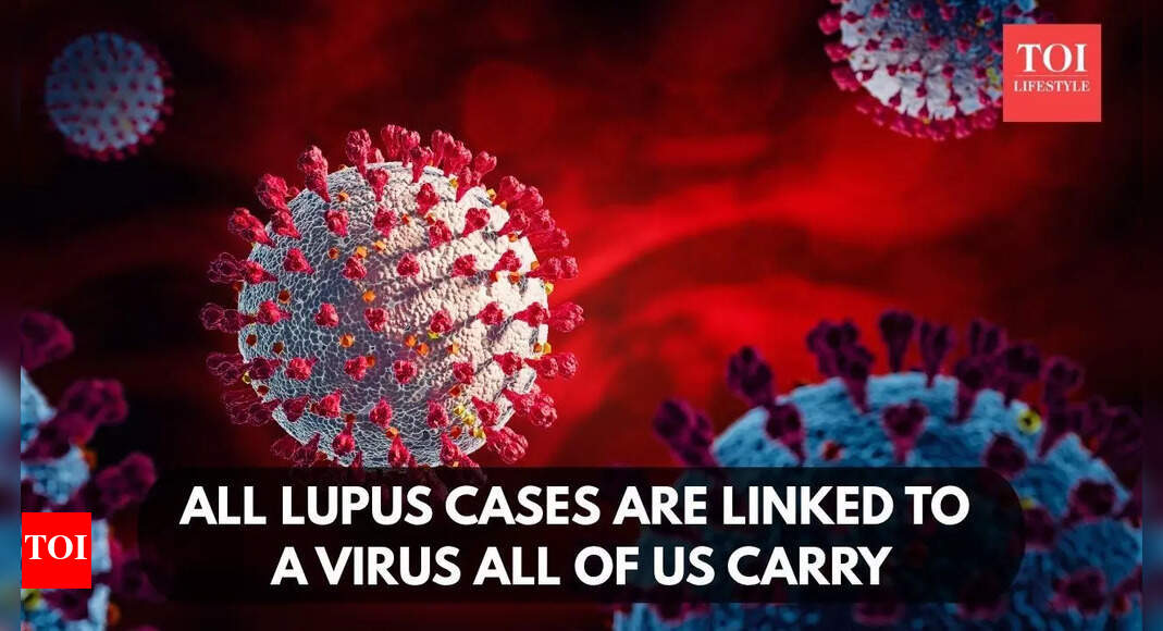 All lupus cases are linked to a virus all of us carry, study finds