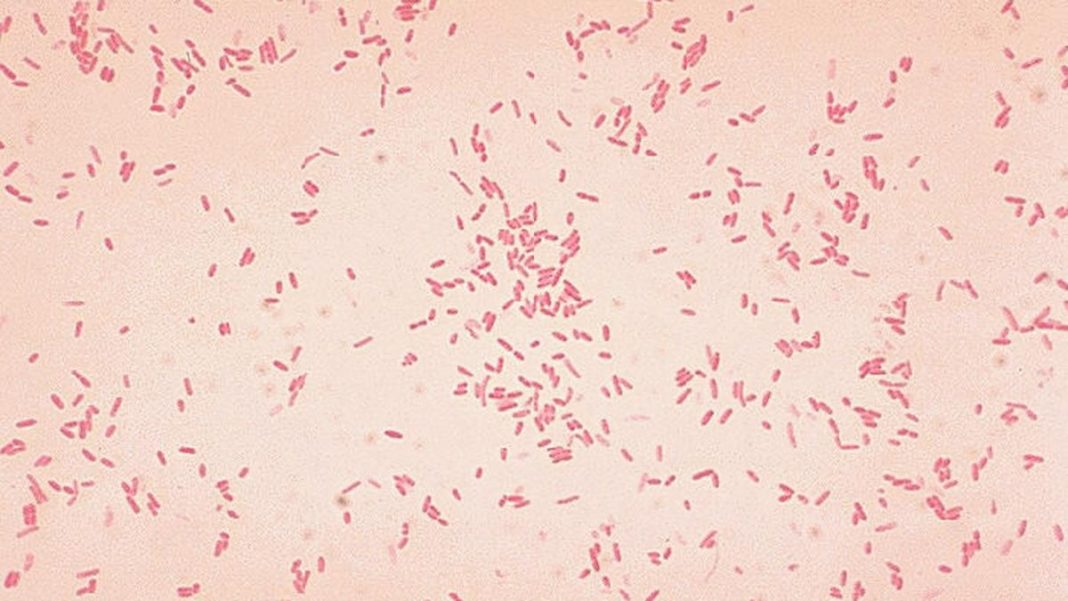 Microbe might spark first stages of ulcerative colitis: new study Microbe might spark first stages of ulcerative colitis: new study