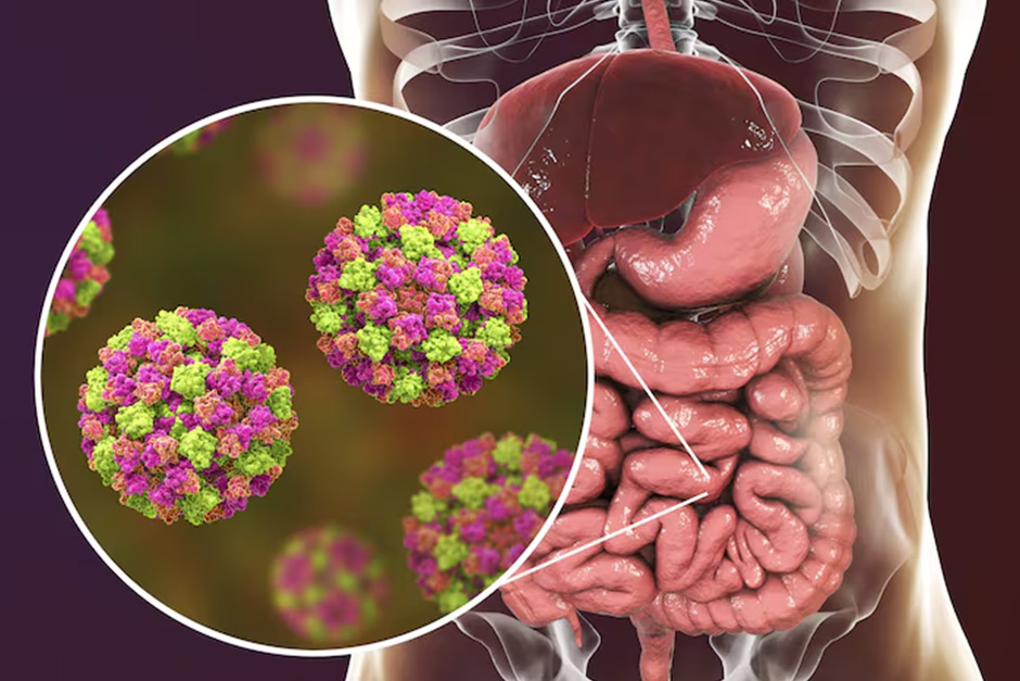 A super contagious winter stomach bug is spreading like crazy nationwide. A super contagious winter stomach bug is spreading like crazy nationwide.