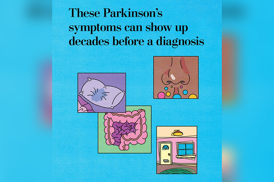 4 Parkinson’s symptoms you might notice decades before a diagnosis.