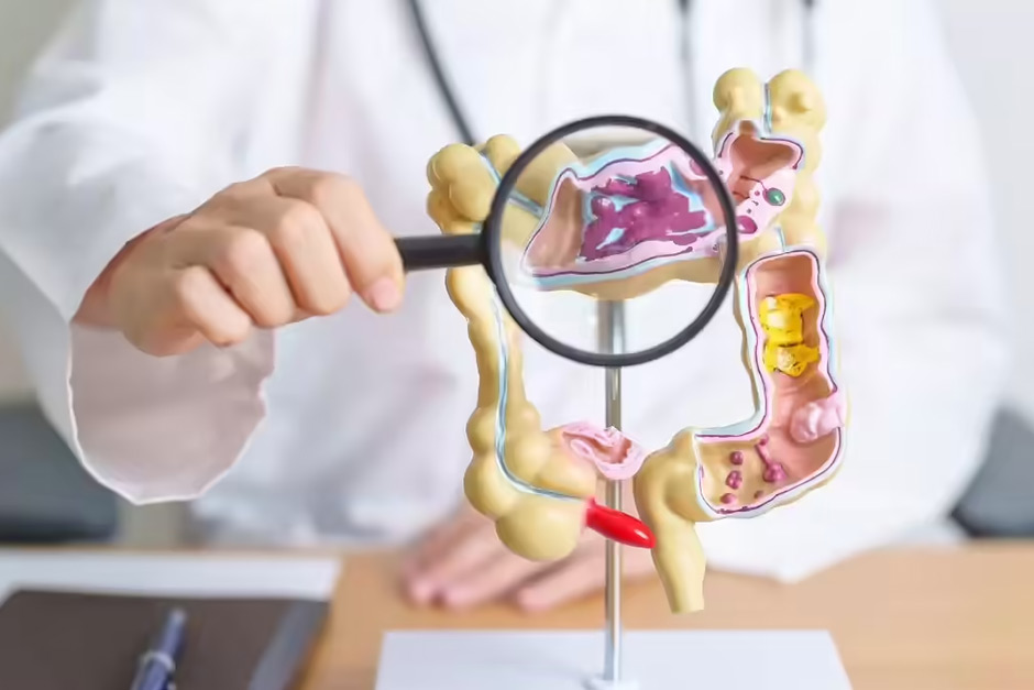 Beyond Sleep: Could Magnesium Be a Key Player in Colorectal Cancer Prevention?