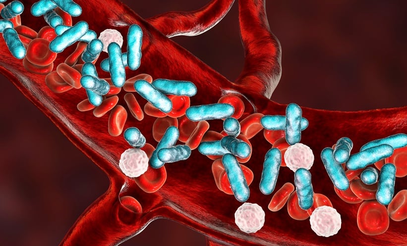 Key Predictors of Death in Septic Shock Identified