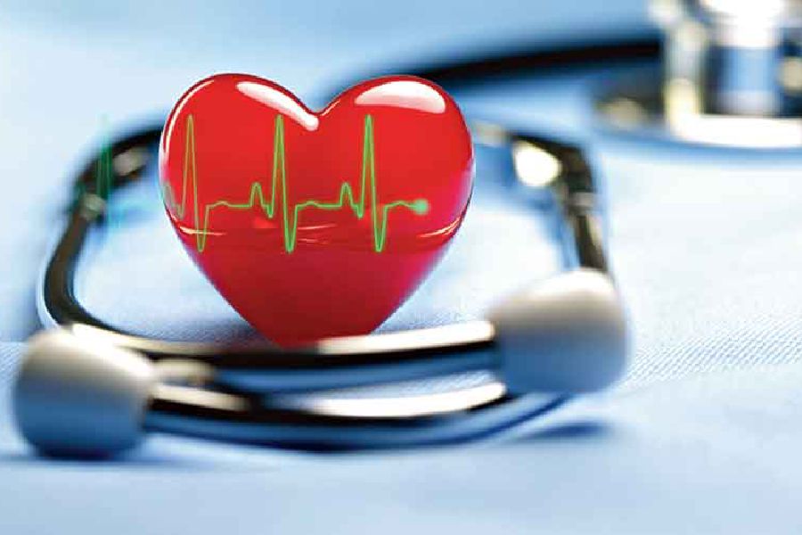 Women face heart risks at lower plaque levels than men, study urges gender-specific care Women face heart risks at lower plaque levels than men, study urges gender-specific care