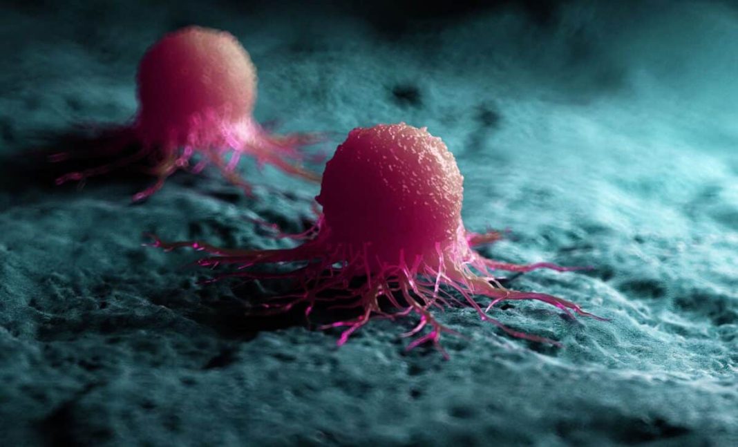 A tumor's clever trick: staying hidden from the immune system for years. A tumor's clever trick: staying hidden from the immune system for years.