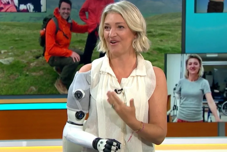 A British woman says she’s 80% human and 20% robot, thanks to her mind-reading bionic arm.