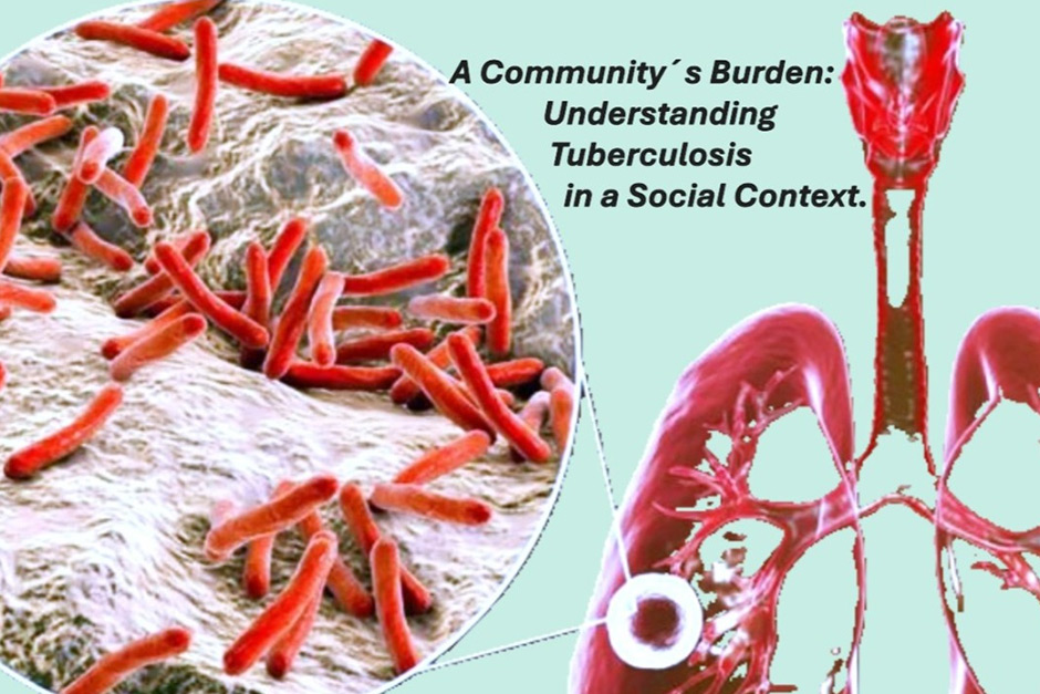 Tuberculosis Misdiagnosis Poses Persistent Global Health Challenge