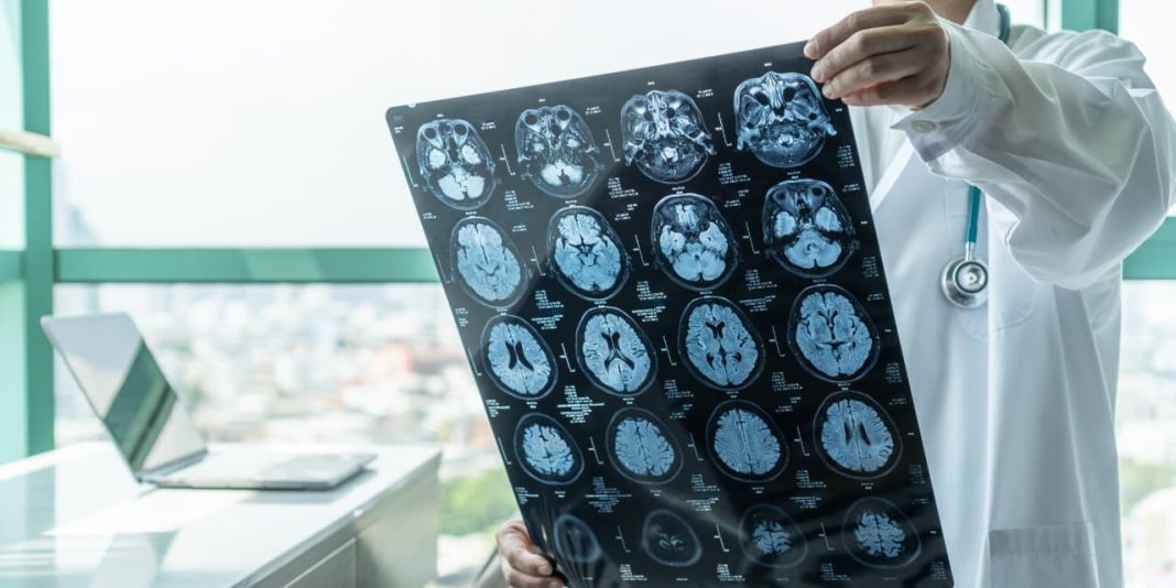 Medicare vs. Medicare Advantage: How Their Stroke Prevention and Treatment Really Differ, and What It Means for You. Medicare vs. Medicare Advantage: How Their Stroke Prevention and Treatment Really Differ, and What It Means for You.