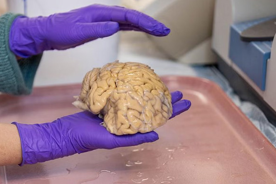 What’s the secret to ‘super-ager’ brains? Science explains.