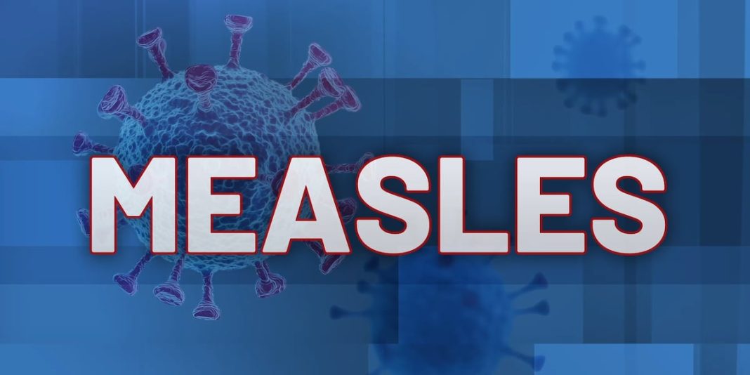 Possible measles exposure at an eastern Iowa hotel. Possible measles exposure at an eastern Iowa hotel.
