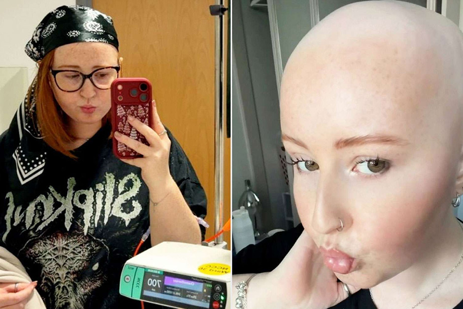 When a ‘Pulled Muscle’ isn’t: Young Brit’s Cancer Misdiagnosis