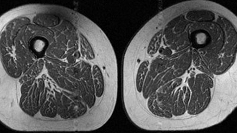 Processed foods are making our thighs look like marbled steak.