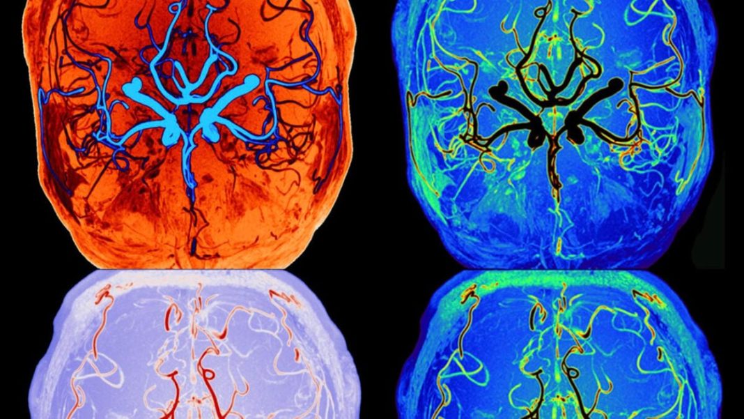 Scientists just watched the brain clean itself in action while you sleep.