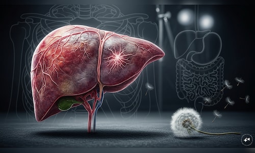 Liver disease cases may hit 1.8 billion by 2050; 1.3 billion affected in 2023: Lancet study Liver disease cases may hit 1.8 billion by 2050; 1.3 billion affected in 2023: Lancet study