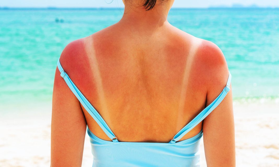 Surprise! Scientists just found the *real* reason you get sunburned, and it's changing the textbooks.